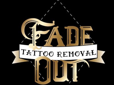 Fade Out Tattoo Removal