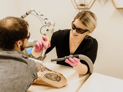 Fade Out Tattoo Removal
