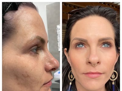 Medical Tattoo & Cosmetic Centers of America