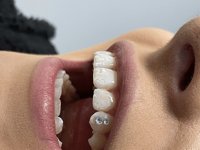 Medical Tattoo & Cosmetic Centers of America