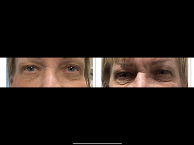 Medical Tattoo & Cosmetic Centers of America