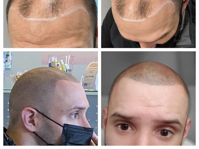 Medical Tattoo & Cosmetic Centers of America