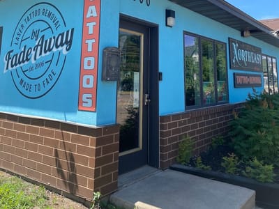 Northeast Tattoo & Fade Away Laser Tattoo Removal